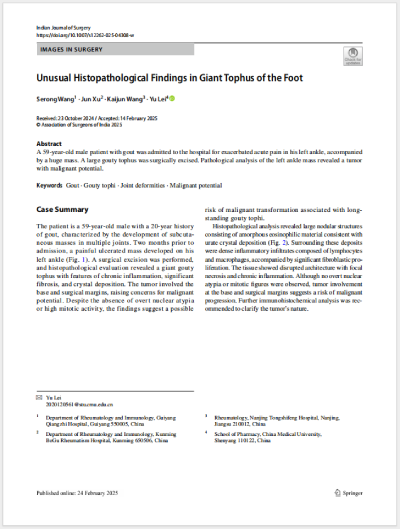 36����ɫ�����εȹ�ͬ׫д�����¡�Unusual Histopathological Findings in Giant Tophus of the Foot�����㲿�޴�ʹ��ʯ���쳣��֯����ѧ���֣���SCI�ڿ���Indian Journal of Surgery��������.png